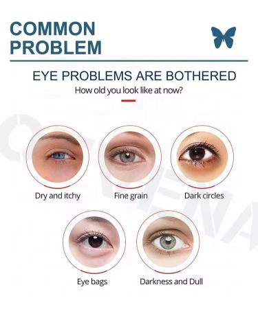 OTVENA Instant Eye Cream for Dark Circles & Puffiness Anti-Aging Under Eye Treatment for Wrinkles & Fine Lines Visible Results in Minutes Firming & Hydrating Formula 8ML - Buy Online on GoSupps.com