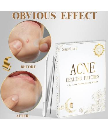 252 PCs 2-in-1 Acne Pimple Patch - Day & Night Acne Treatment for Fast Healing - Buy Online on GoSupps.com