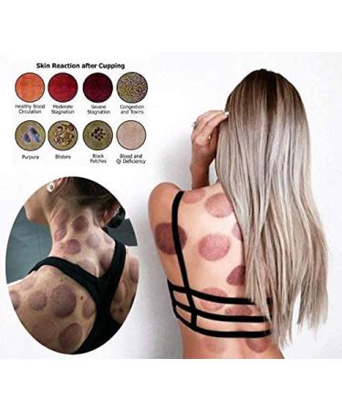 Professional Chinese Acupoint Cupping Therapy Set with Vacuum Magnetic Pump - 22 Cup Portable Suction Hijama Massage Kit - Cellulite Cupping Gift Box - Buy Online on GoSupps.com