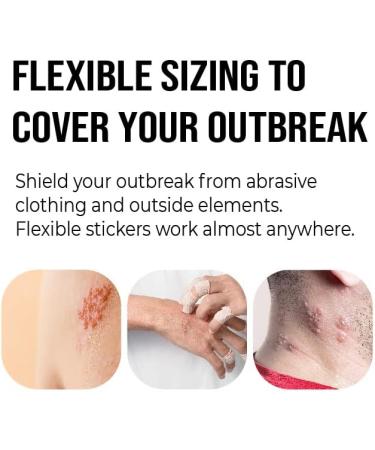 ShingleShield Treatment Patch - Natural Relief for Shingles Blister Pain and Rash - Buy Online on GoSupps.com