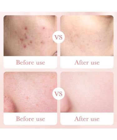 Rose Toner for Face Korean Skincare Rose Smoothing Toner for Face Rose Water Hydrating Facial Toner Smoothing Moisturizing Pore Exfoliating Toner Friendly Vegan - Buy Online on GoSupps.com