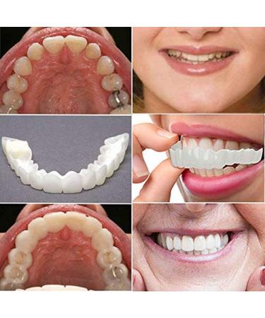 Instant Snap Veneers: Teeth Socket Perfect Braces & Whitening Alternative - No Pain, No Shots, No Drilling (1 Upper + 1 Lower + 2 Adhesives) - Buy Online on GoSupps.com
