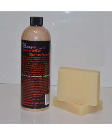 Carley's Clear & Smooth Acne Treatment for Teens and Severe Adult Acne