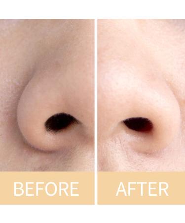 ViiLife Nose Wax Sticks Applicators 100 Pcs - Nasal Hair Removal & Nostril Cleaning - Ear Hairs, Face, Eyebrows Hair Removal - 100 Count - Buy Online on GoSupps.com