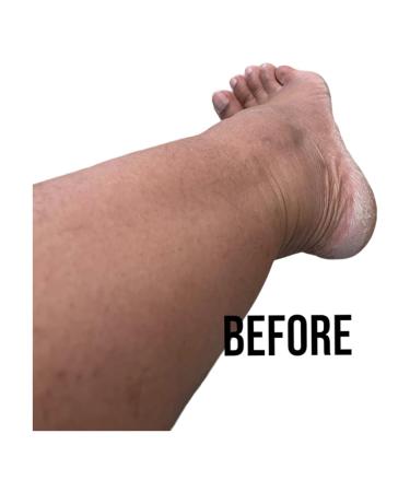 Citrus Body Butter 4 oz - Nourishing Moisturizer for Soft Hydrated Skin | Shop Internationally - Buy Online on GoSupps.com