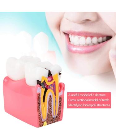High-Quality Dental Prosthesis Model for Oral Care | International Shipping Available - Buy Online on GoSupps.com