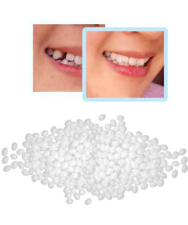 Temporary Tooth Repair Kit - Denture Repair Beads for Missing or Broken Teeth - Buy Online on GoSupps.com