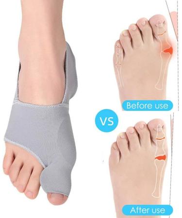Keduoduo 2-Piece Foot Care Set | Big Toe Hallux Valgus Corrector & Bunion Straightener - Orthotics Pedicure Socks - Buy Online on GoSupps.com