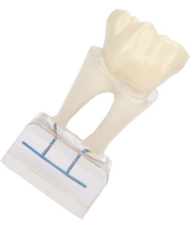 Professional Dental Nerve Model for Teaching | Resin Tooth Model for Students | International Shipping - Buy Online on GoSupps.com