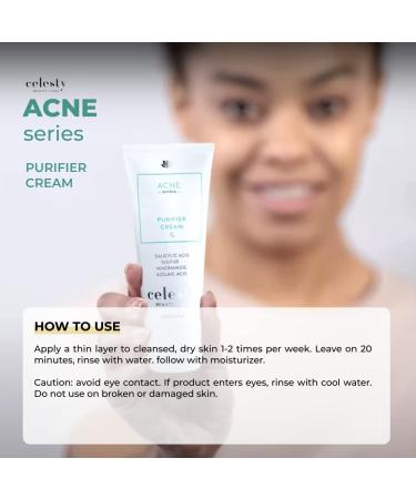 Celesty Beauty Hormonal Acne Face Moisturizer | Liquid Cream Purifier for Hormonal Acne | 60ml Acne Spot Treatment & Vitamin-Enriched Formula - Buy Online on GoSupps.com