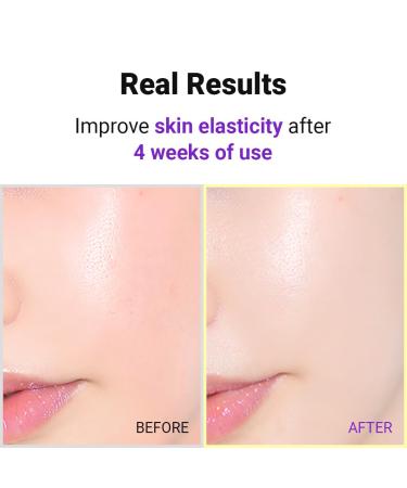 ISNTREE Hyper Retinol EX 1.0 Serum 20ml | Anti-Aging with 5 Peptides & 5 Ceramides | Reduce Fine Lines Worldwide Shipping - Buy Online on GoSupps.com