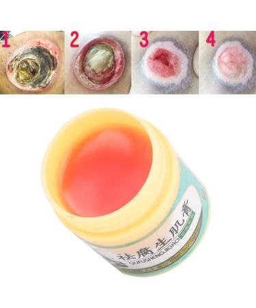 10g Bed Sore Cream for Wound Care and Healing - Remove Rots and Pressure Ulcers with Body Care Ointment - Buy Online on GoSupps.com