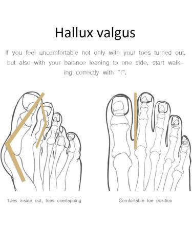 Gel Toe Separators - Correct Overlapping Toes - Hallux Valgus Foot Care Tools - Buy Online on GoSupps.com