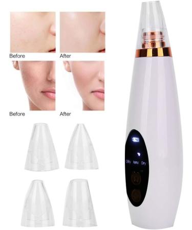 Blackhead Removal Vacuum - Adjustable Suction Pore Cleanser Beauty Device - USB Rechargeable - White - Buy Online on GoSupps.com