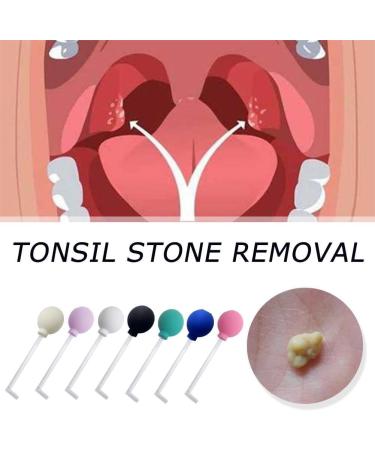 Tonsil Stone Remover Tool - Manual Style Cleaner for Fresh Breath (Pack of 2) - Buy Online on GoSupps.com
