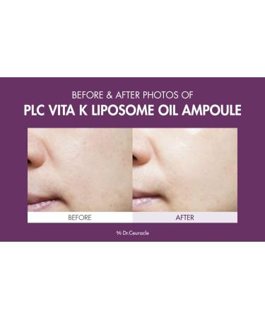Leegeehaam PLC Vitamin K Liposome Oil Ampoule - Toning, Glowing, Hydrating Serum for Brighter Skin | Dr.Ceuracle - Buy Online on GoSupps.com