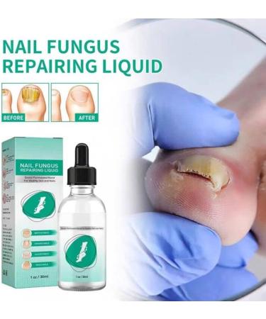 Kerassentials Toenail Fungus Treatment Oil Best Repair Solution for Fingernails and Toenails Fix & Renew Damage Fungal Nail Broken Cracked & Discolored Nails - Buy Online on GoSupps.com