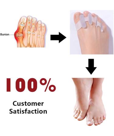 Toe Spreader for Hallux Valgus Relief | Silicone Correction for Bunions & Overlapping Toes | Comfortable Day & Night Use (2 Pieces) - Buy Online on GoSupps.com