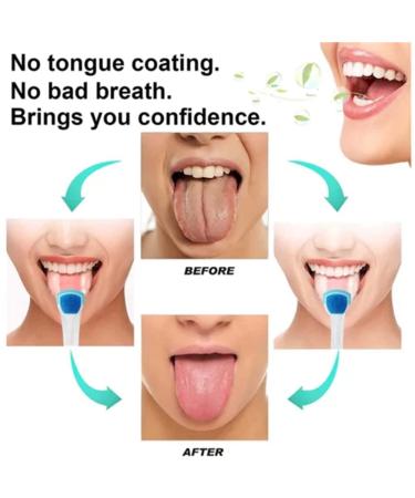 Probiotic Tongue Cleaning Gel Set with Tongue Scraper and Brush Kit - Mint Flavor | Oral Hygiene Brush and Tongue Cleaner Set - Buy Online on GoSupps.com