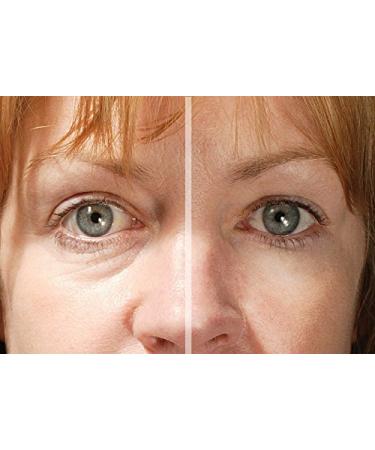 Rox Flawless Eyes by RX | Premium Eye Care for Radiant Skin | Shop Internationally Now - Buy Online on GoSupps.com
