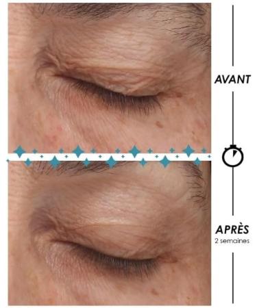  Garancia toile POLAR - Eye contour Anti-aging Meno-expert - Buy Online on GoSupps.com
