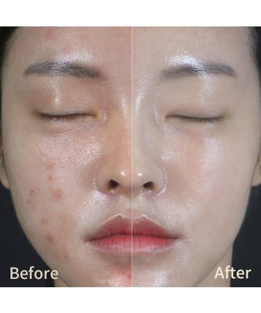 HUR Water Repair Cream - Soothing Moisture Cream for Face 2.82oz | Korean Skin Care & Cosmetics - Buy Online on GoSupps.com