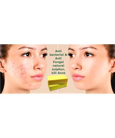 Sulphur Soap 10% Sulfur 200g Avena Sulphur Soap Rid Severe Acne Rosacea - Buy Online on GoSupps.com
