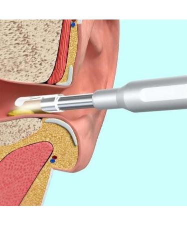 Earwax Remover Tool Otoscope Endoscope with LED Lights & Camera Ear Cleaner Ear Pick Ear Cleaning Kit for Kids Adults & Pets - Buy Online on GoSupps.com