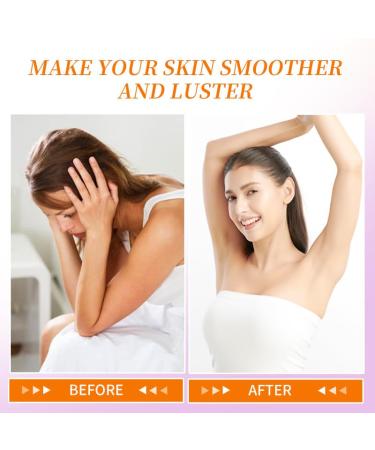 Intimate Area Dark Spot Corrector Cream - 2oz Niacinamide & Shea Butter for Underarm Neck Elbow Brighten & Smooth Rough Skin Upgraded Formula - Buy Online on GoSupps.com