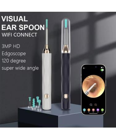 LED Ear Scoop Cleaning Camera - WiFi Otoscope & Endoscope Ear Wax Remover Tool (Black) | Fast International Shipping - Buy Online on GoSupps.com
