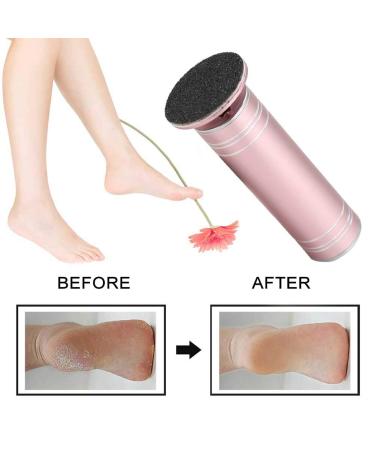 Buy Automatic Electrical Foot Horn Skin Remover - 60 Replacement Grinding Paper Slices - Powerful Pedicure Tool (Pink EU Standard) - Fast International Shipping - Buy Online on GoSupps.com