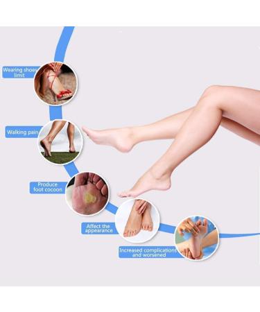 CAZARU FXJ Toe Separator & Corrector with Valgus Pads - Orthopedic Splint for Toe Alignment & Pain Relief - Buy Online on GoSupps.com