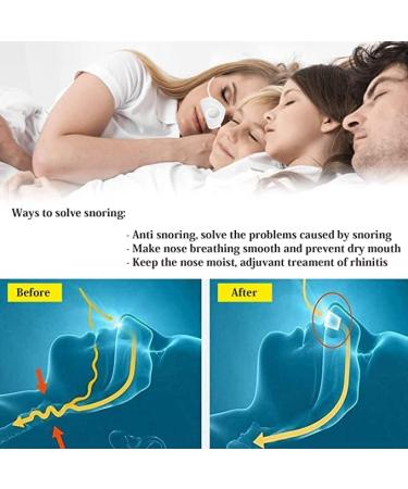 2021 Anti-Snoring Solution: 4-in-1 Atomization Device for Sleep Apnea - Adjustable Wind Force for Comfortable Sleep - White - Buy Online on GoSupps.com