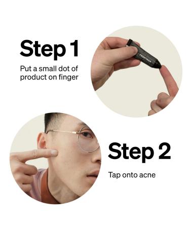 FRONTMAN Fade Men's Acne Concealer with Salicylic Acid | Natural Coverage for Blemishes & Dark Circles | Non-Greasy Formula | Fragrance-Free | L2 Light Shade | 0.33oz - Buy Online on GoSupps.com