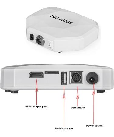 Intraoral Camera for Dental Observation | HDIM/VAG Interface | TV & Computer Display - Buy Online on GoSupps.com