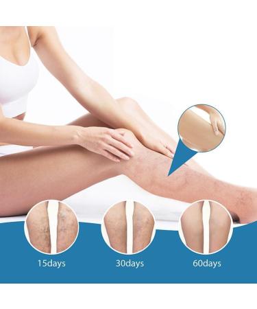 GeRRiT Organic Varicose Vein Treatment Cream Varicose Vein Treatment Varicose Vein Treatment on Legs Reduces Spider Veins and Heaviness - Buy Online on GoSupps.com