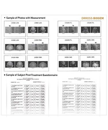 Dr Ross BIOGEM pH-Balanced Revitalizing Shampoo for Oily Hair - 355ml | Shop Internationally for Healthy Hair - Buy Online on GoSupps.com