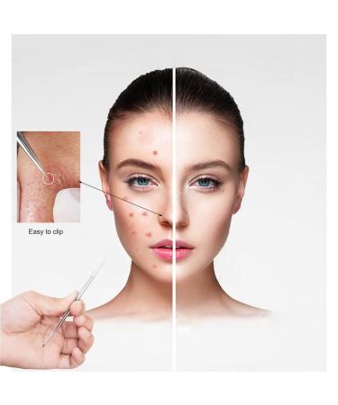 Stainless Steel Precision Tweezer for Ingrown Hair & Blackhead Removal - Buy Online on GoSupps.com