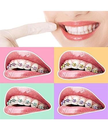 QUUPY 1040pcs Multicolor Orthodontic Ligature Ties & O-Rings for Braces | Elastic Bands for Ultimate Comfort - Buy Online on GoSupps.com
