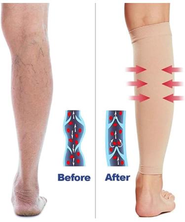 Regular Graduated Compression Sleeves for Men & Women - Firm Support Footless Socks for Varicose Veins Shin Splints Edema Recovery & Diabetic Flights | Hautton - Buy Online on GoSupps.com