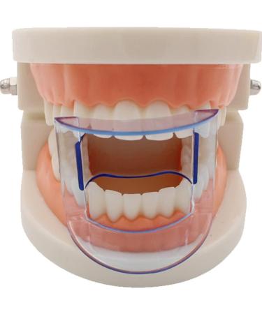 Baokuan 5pcs Dental Mouth Retractor & Tube Expander Oral Care Tool for Clinics & Home Use - Blue - Buy Online on GoSupps.com