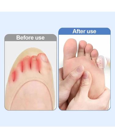 Silicone Anti-Friction Toe Protector - Gel Toe Covers for Pain Relief Blisters Calluses & Corns (30pcs) - Soft & Breathable Foot Care Solution - Buy Online on GoSupps.com
