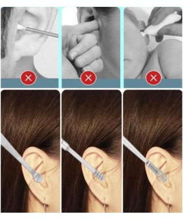 6pcs Stainless Steel Ear Wax Remover Set for Baby & Adults - Black - Buy Online on GoSupps.com