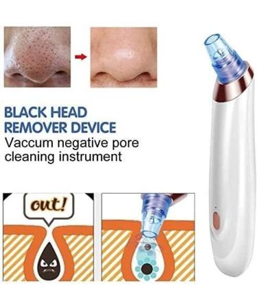 QINERSAW Blackhead Remover Pore Cleaner Blackheads Pore Sucker with 5 Suction Heads Acne Comedone Extractor Kit Blackhead Removal Tool for Beauty Salon (Color : Red) (Color : White) - Buy Online on GoSupps.com