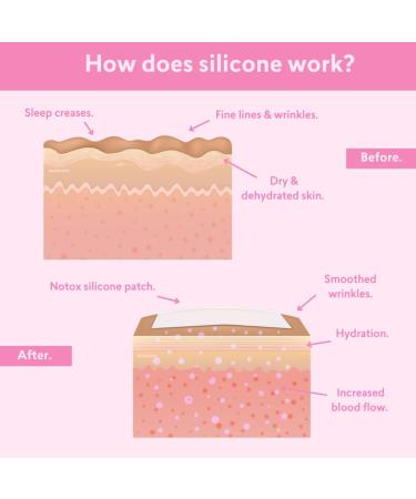 Notox Forehead + Frown Lines - Nudie Face - 100% Medical Grade Silicone Wrinkle Patch - Reusable Silicone Face Patch To Reduce Fine Lines and Wrinkles - Wrinkle Smoothing - Fast Results - Buy Online on GoSupps.com