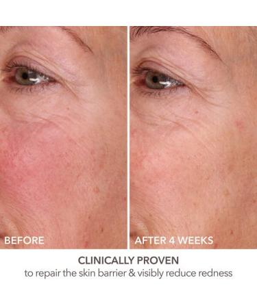 Dr Dennis Gross DermInfusions Fill + Repair Serum - Instant Line Filler & Skin Plumper 1 oz | International Shipping Available - Buy Online on GoSupps.com