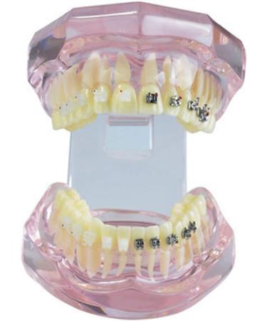 Tooth Pattern Dental Orthodontic Studio Template | Dental Oral Model for Pathological Anatomy Study - Buy Online on GoSupps.com