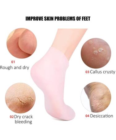 rongweiwang 3 Pairs Moisturizing Socks Foot SPA Pedicure Socks Exfoliating Anti-Drying Sock Repair Heel Protector for Woman L - Buy Online on GoSupps.com