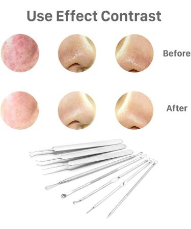 YIAGUN Acne Blemish Needles Tool Kit Nose Face Skincare 8-in-1 with Metal Case - Buy Online on GoSupps.com