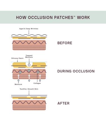 Buy Dermaclara Silicone Fusion Anti-Wrinkle Patches - Reusable Treatment for Fine Lines Under Eye Forehead & Neck Wrinkles - Pregnancy Safe Skincare Solutions - Buy Online on GoSupps.com